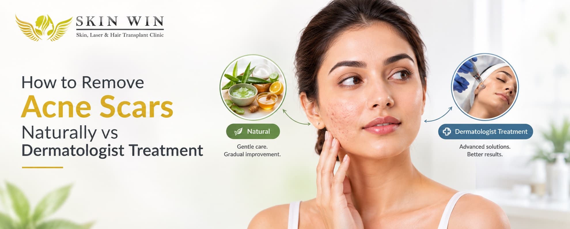 How to Remove Acne Scars Naturally vs Dermatologist Treatment